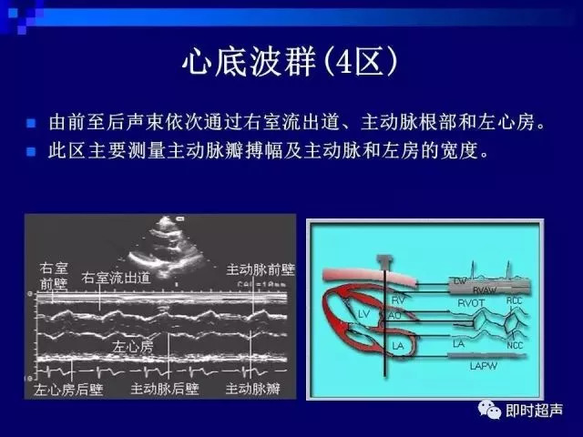 心脏超声解剖及正常声像图