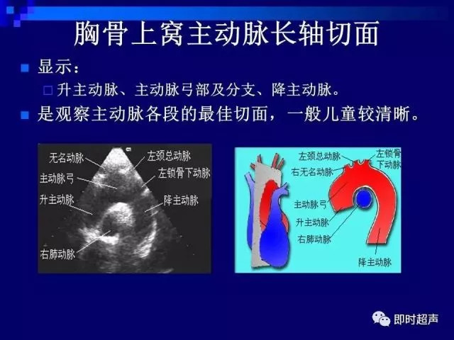 心脏超声解剖及正常声像图