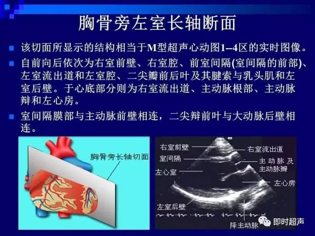 心脏超声解剖及正常声像图