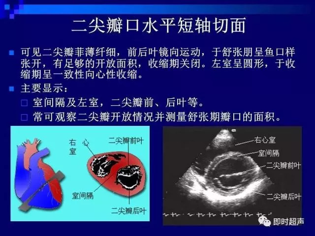 心脏超声解剖及正常声像图