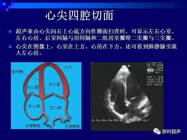 心脏超声解剖及正常声像图