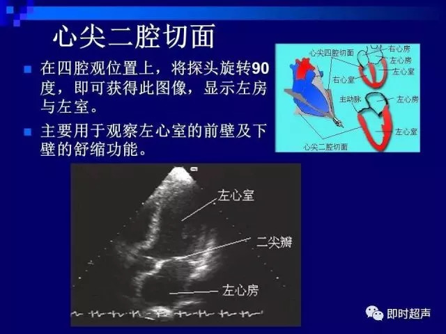 心脏超声解剖及正常声像图