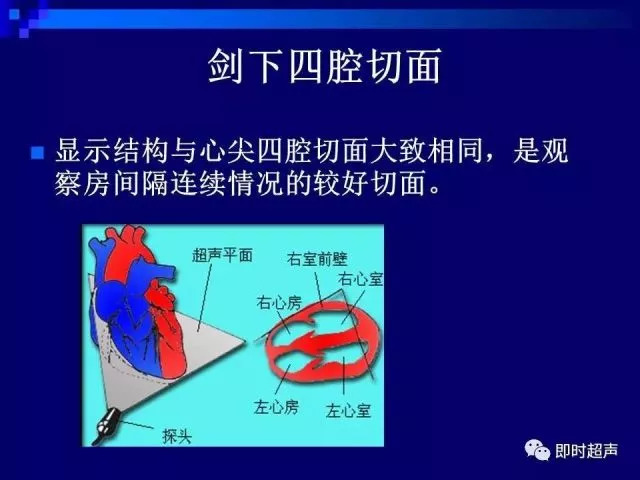 心脏超声解剖及正常声像图