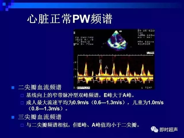 心脏超声解剖及正常声像图