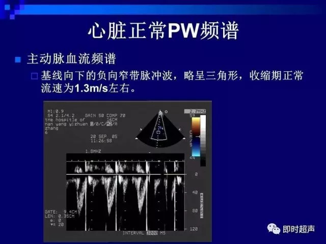 心脏超声解剖及正常声像图