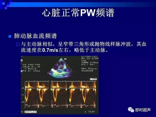 心脏超声解剖及正常声像图