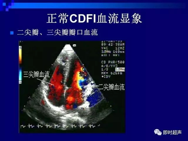 心脏超声解剖及正常声像图