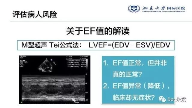 冠心病病人非心脏手术的术前评估（上）