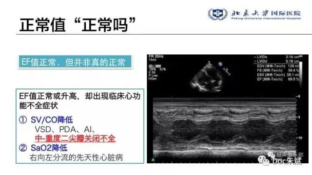 冠心病病人非心脏手术的术前评估（上）