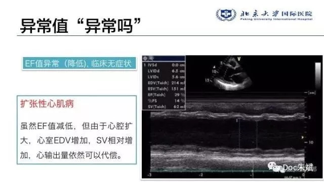 冠心病病人非心脏手术的术前评估（上）