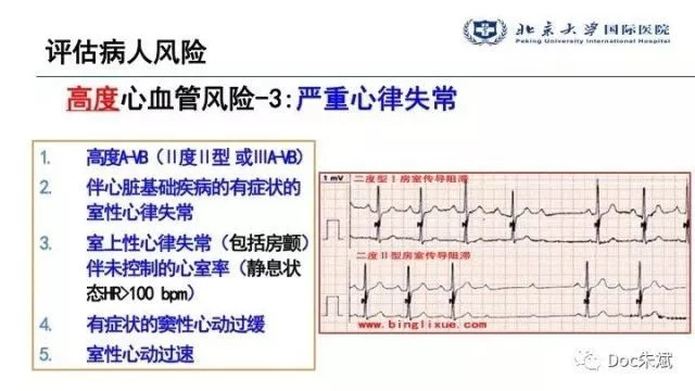 冠心病病人非心脏手术的术前评估（上）