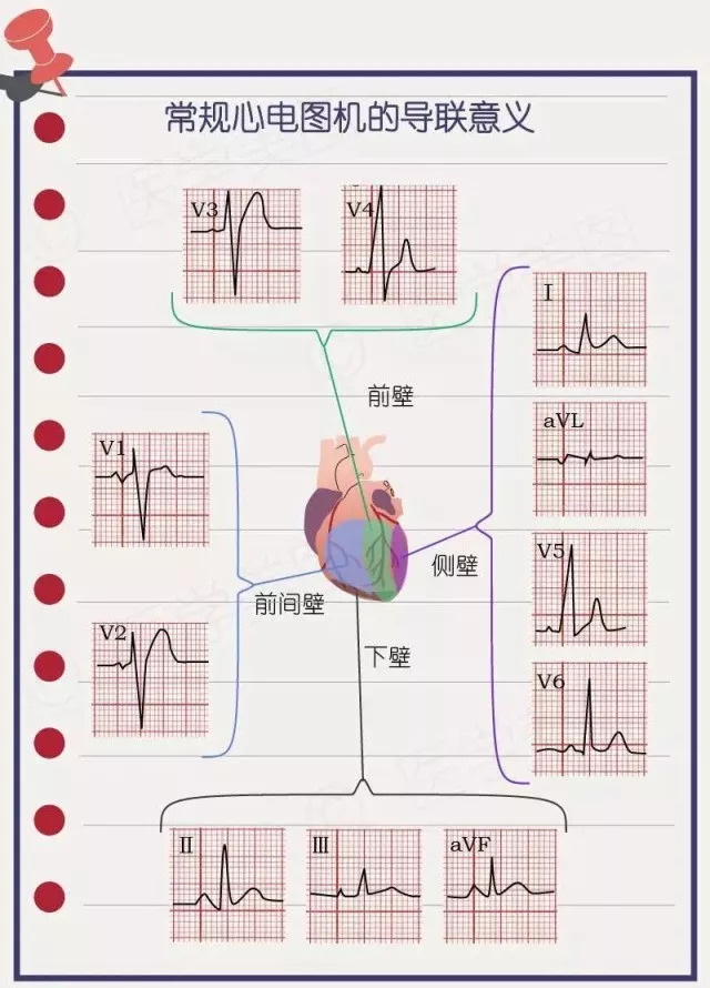 简易心电图教程（一）：如何看正常心电图