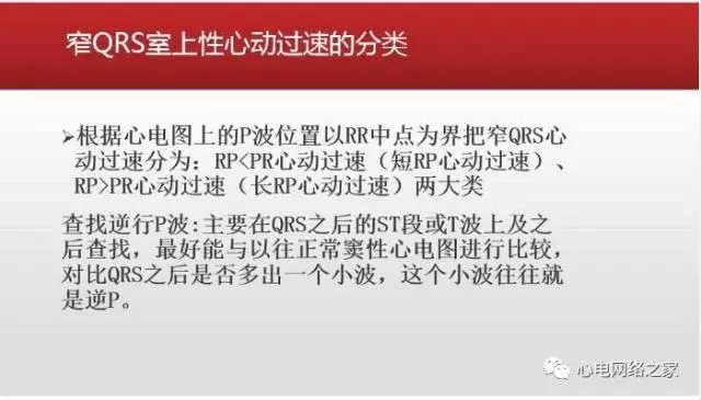 【课件】短RP窄QRS心动过速体表心电图的诊断与鉴别诊断