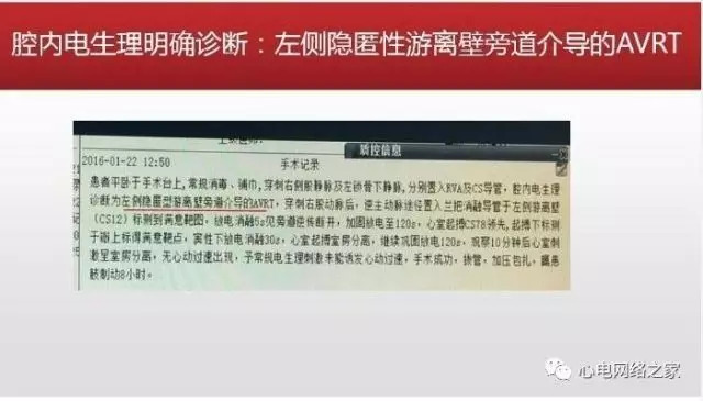 【课件】短RP窄QRS心动过速体表心电图的诊断与鉴别诊断