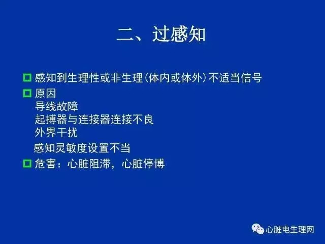 起搏心电图的识别要点