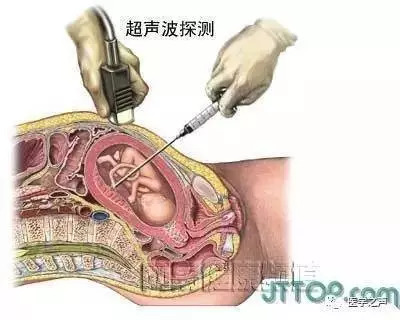 【收藏】史上最全的人体解剖全图