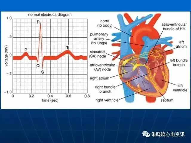 心电图判读