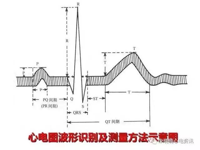 心电图判读