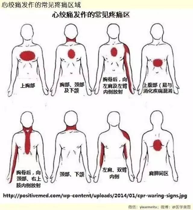 【收藏】55张医学美图讲述各种心脏疾病