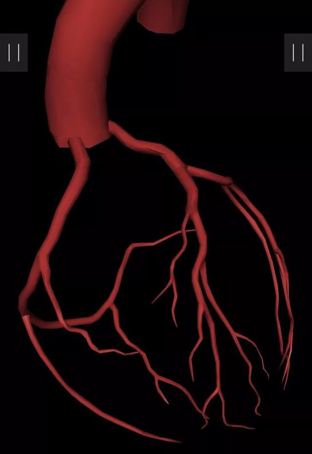 冠脉3D图解，助你轻松掌握造影体位