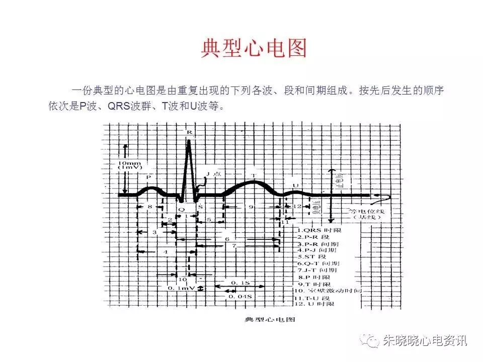 心电图危急值最全总结，赶快收藏备用！