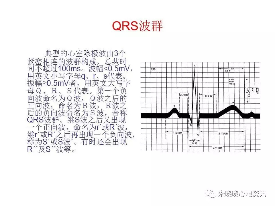 心电图危急值最全总结，赶快收藏备用！