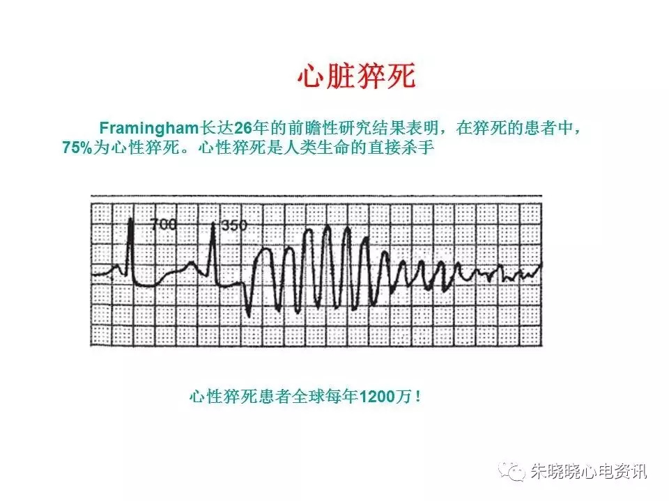 心电图危急值最全总结，赶快收藏备用！