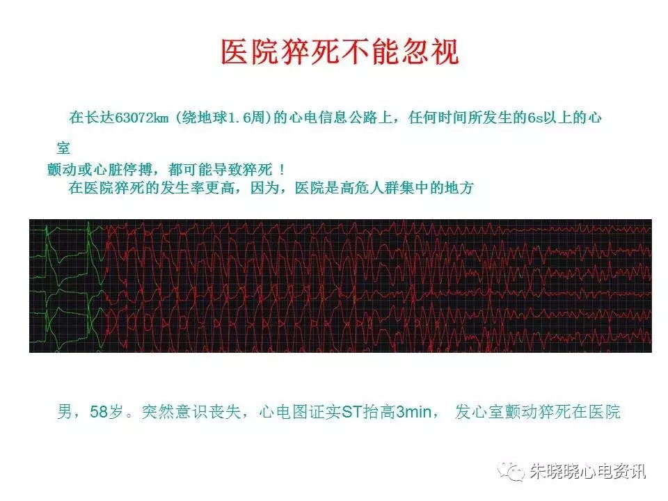 心电图危急值最全总结，赶快收藏备用！