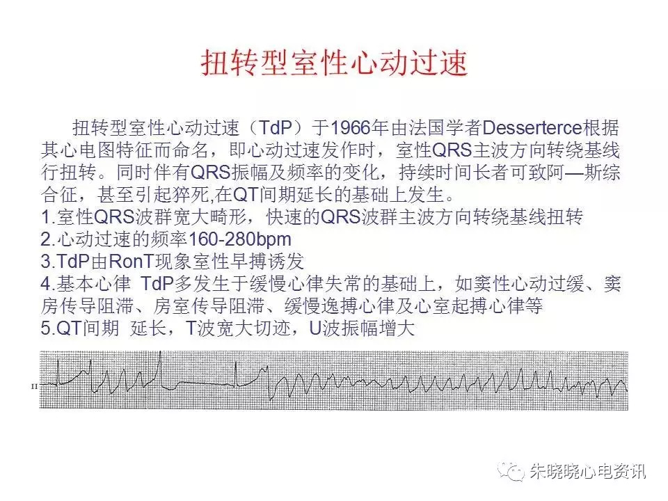 心电图危急值最全总结，赶快收藏备用！