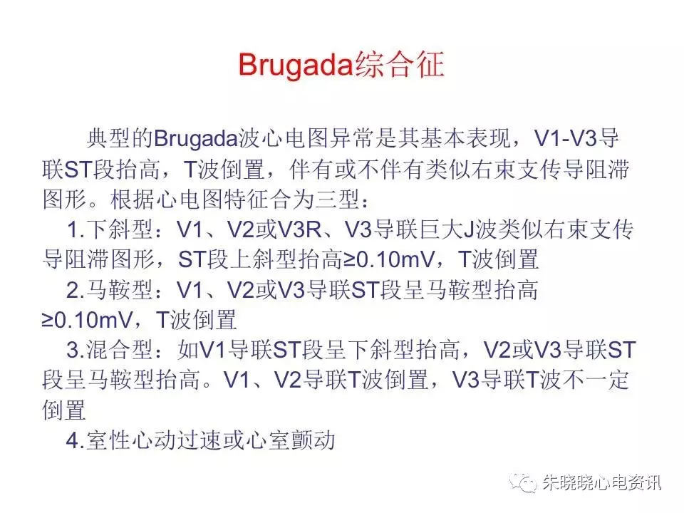 心电图危急值最全总结，赶快收藏备用！