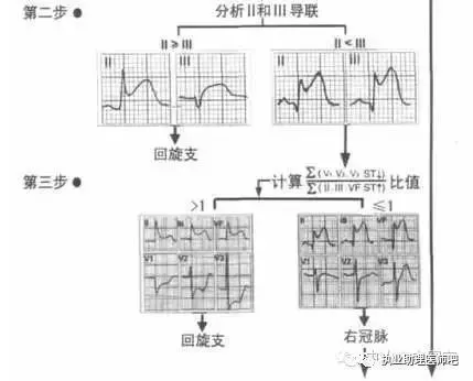 急性心梗时，如何用心电图进行快速定位？