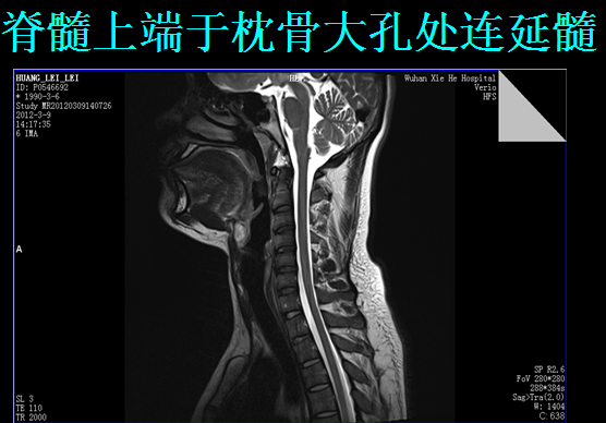 【值得分享】脊柱脊髓解剖（高清大图）