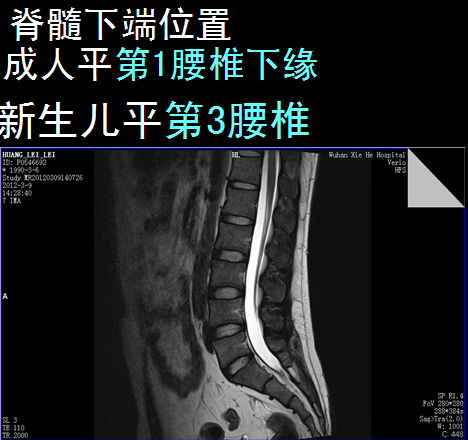 【值得分享】脊柱脊髓解剖（高清大图）