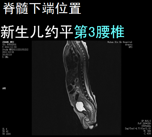 【值得分享】脊柱脊髓解剖（高清大图）