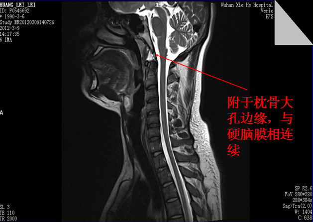 【值得分享】脊柱脊髓解剖（高清大图）