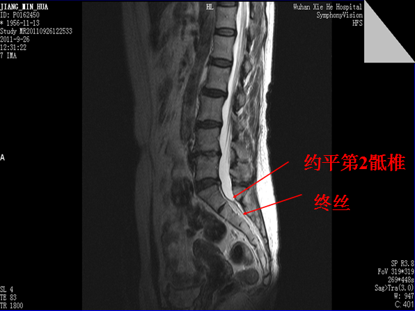 【值得分享】脊柱脊髓解剖（高清大图）