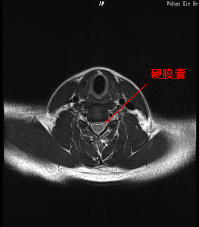 【值得分享】脊柱脊髓解剖（高清大图）