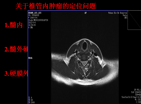 【值得分享】脊柱脊髓解剖（高清大图）