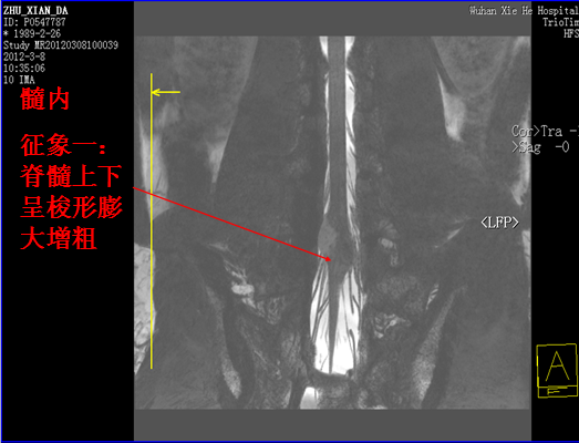 【值得分享】脊柱脊髓解剖（高清大图）