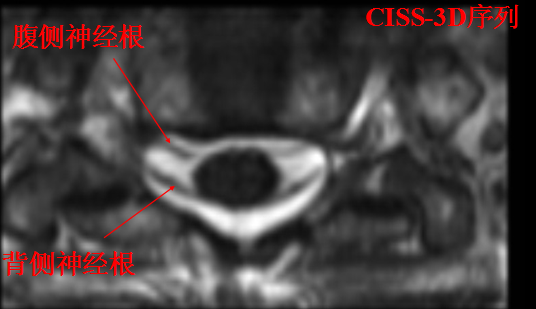 【值得分享】脊柱脊髓解剖（高清大图）