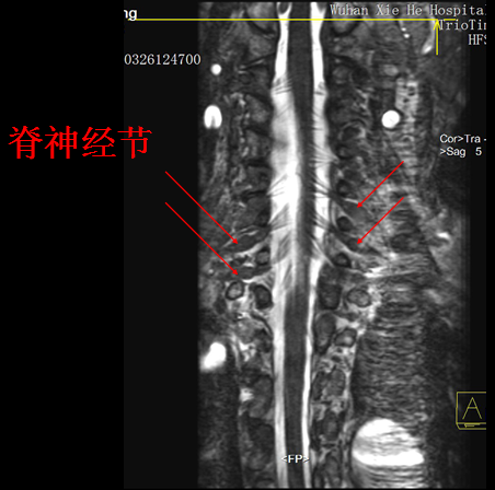 【值得分享】脊柱脊髓解剖（高清大图）