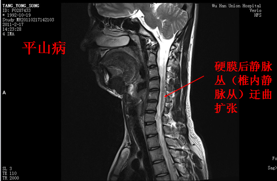 【值得分享】脊柱脊髓解剖（高清大图）