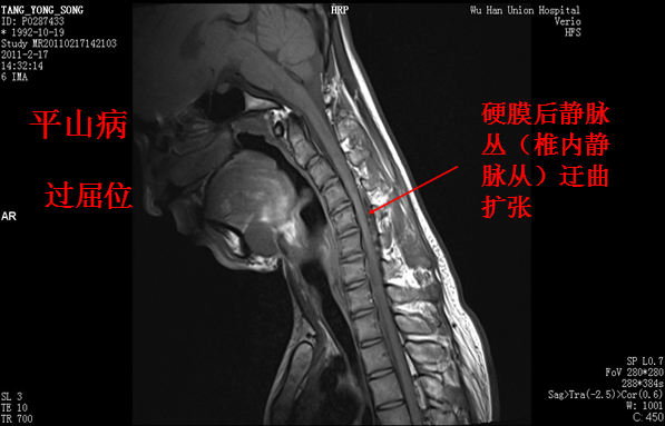 【值得分享】脊柱脊髓解剖（高清大图）