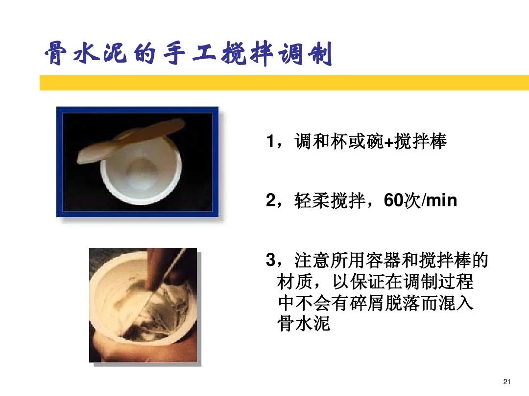 干货！全方位讲解骨水泥的应用和技巧！