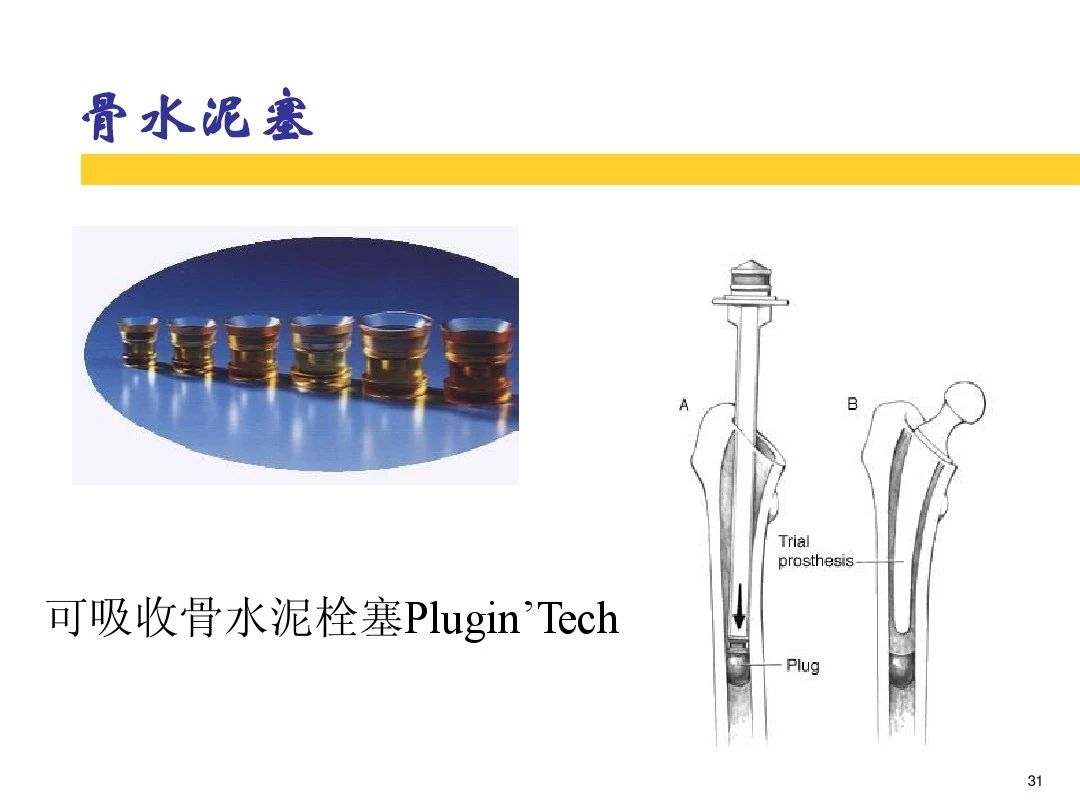 干货！全方位讲解骨水泥的应用和技巧！