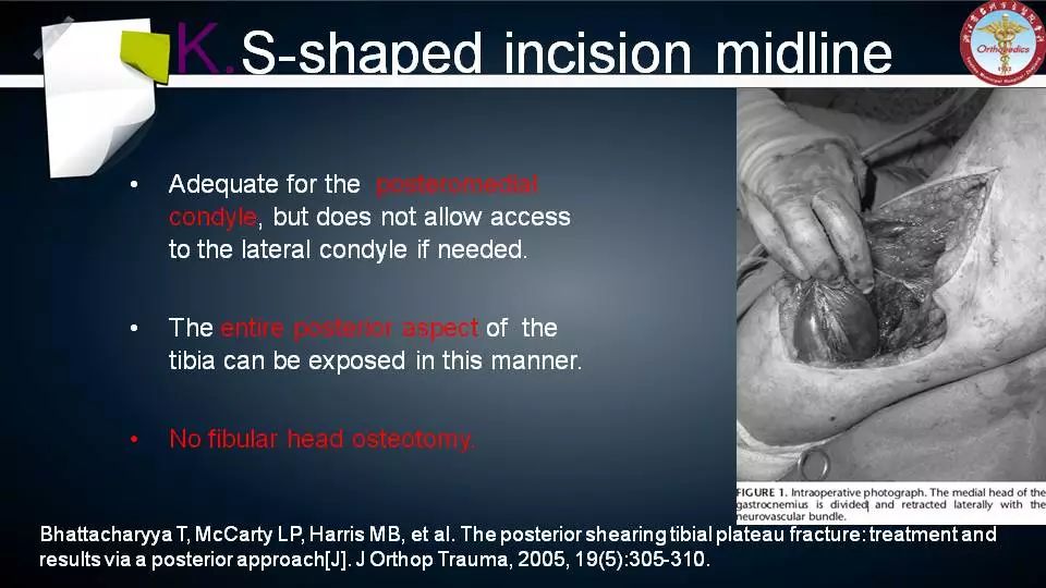 腓骨头截骨入路治疗胫骨后外侧平台骨折