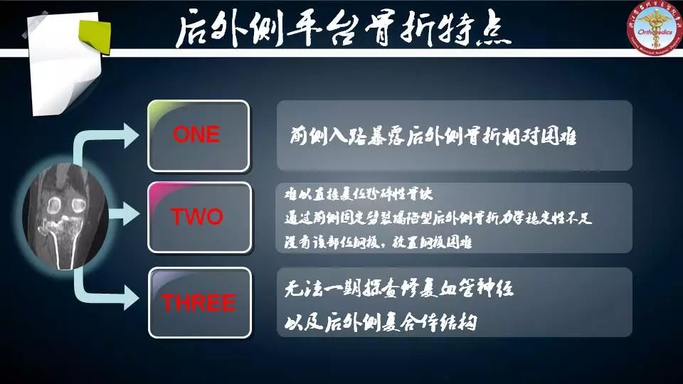 腓骨头截骨入路治疗胫骨后外侧平台骨折