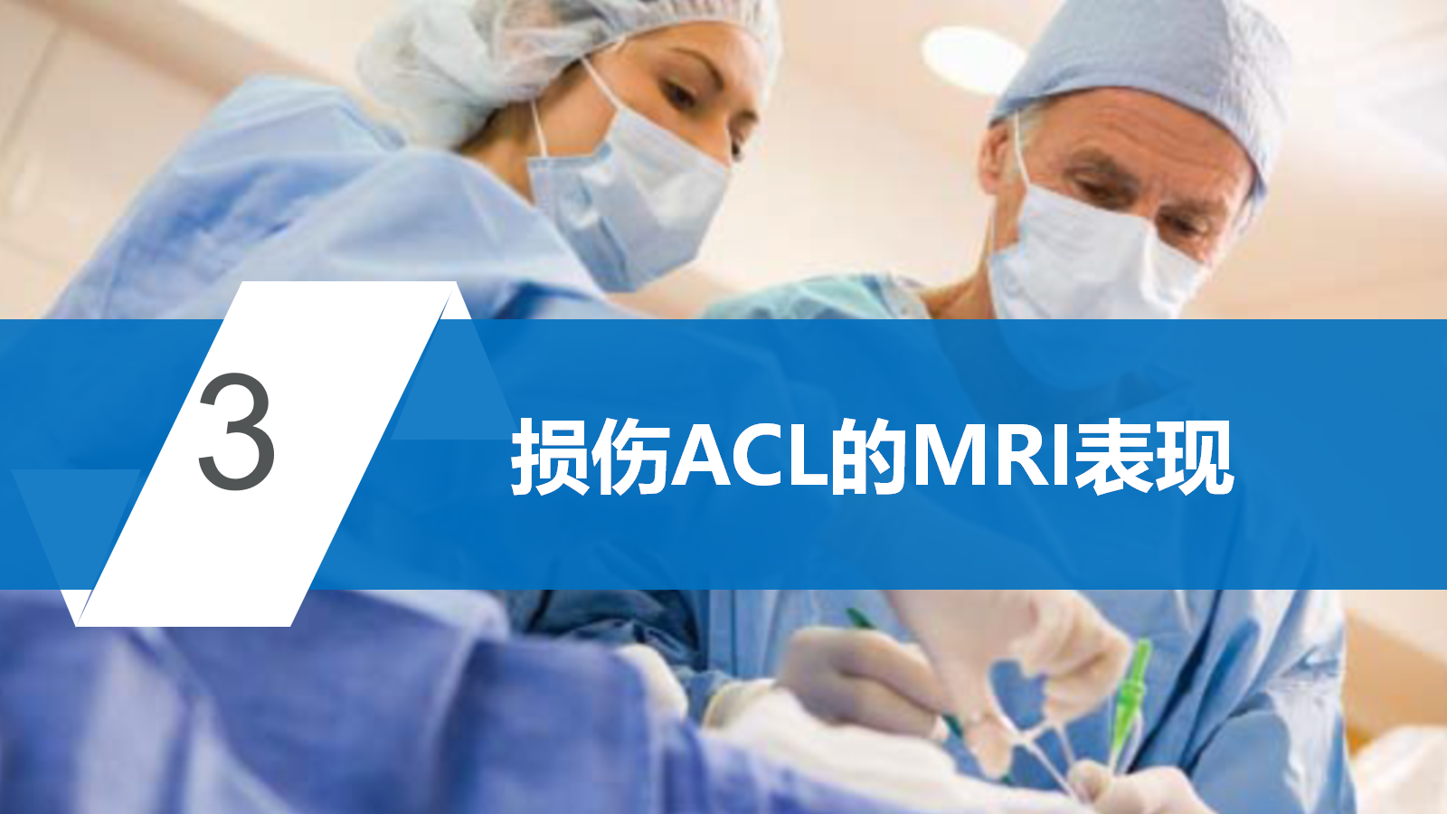 前交叉韧带（ACL）损伤的MRI诊断技巧，详细解析！