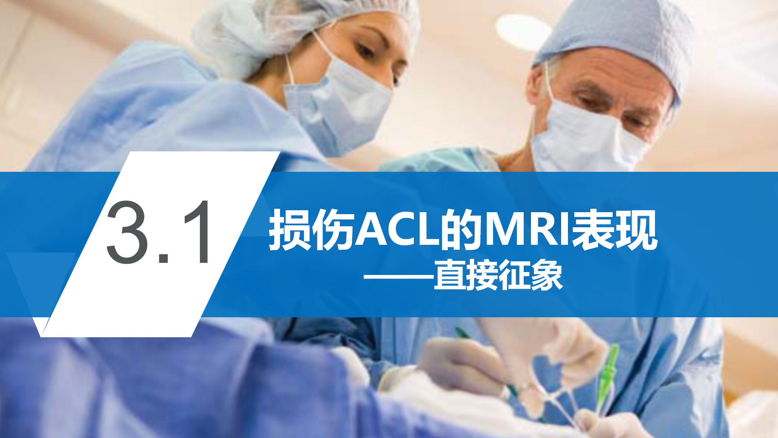 前交叉韧带（ACL）损伤的MRI诊断技巧，详细解析！