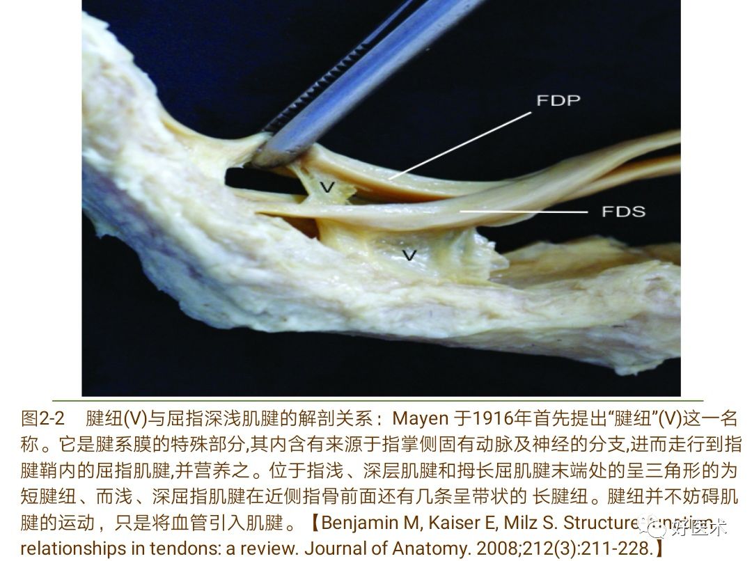 详解治疗球衣指的6种手术方法，你都掌握了吗？